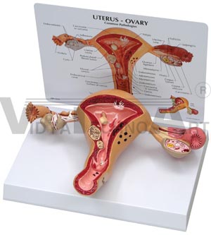 Uterus